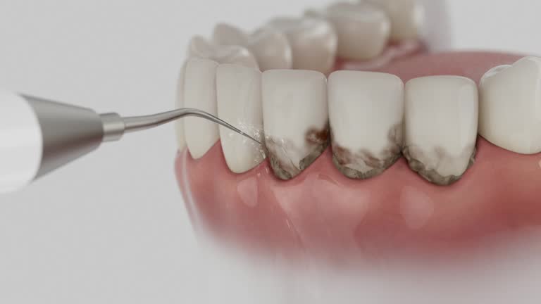 Reliable Root Canal Treatment contractor in St. Helena Parish County, LA by Dentist Open Now